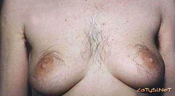 Самая страшная женская грудь (44 фото)